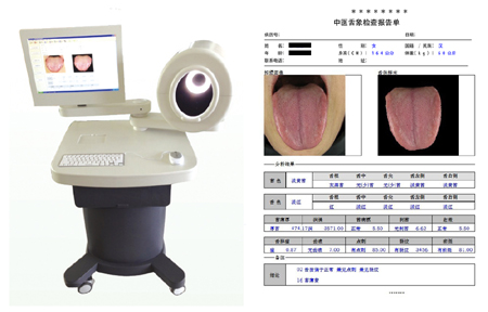 中医舌诊图像分析系统（台车式）中医舌面诊检